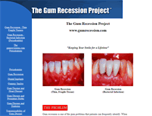 Tablet Screenshot of gumrecession.com